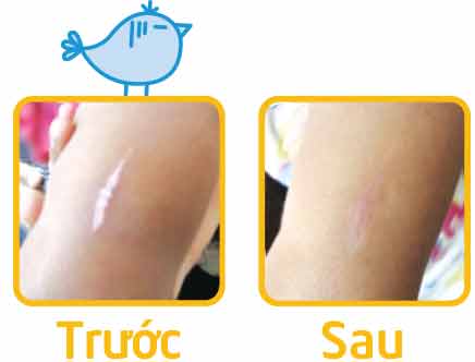 Hiruscar Kid 10g