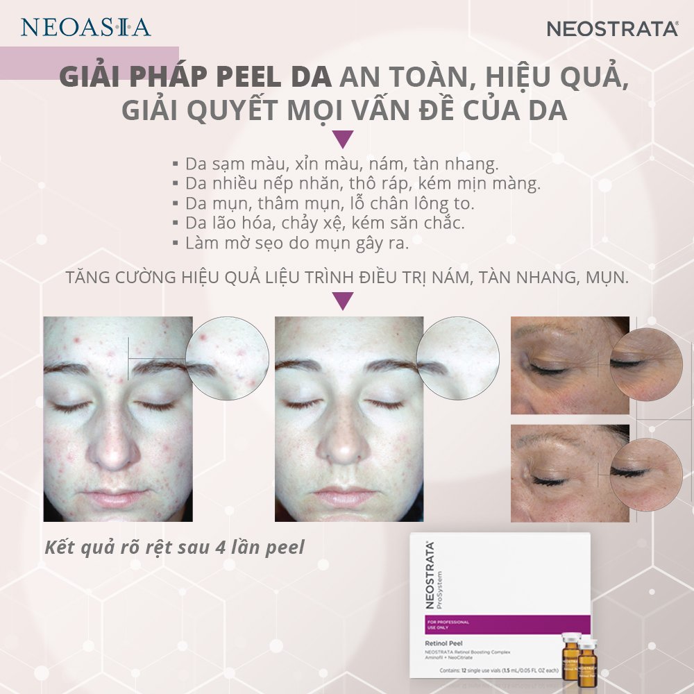 NeoStrata Prosystem Retinol Peel