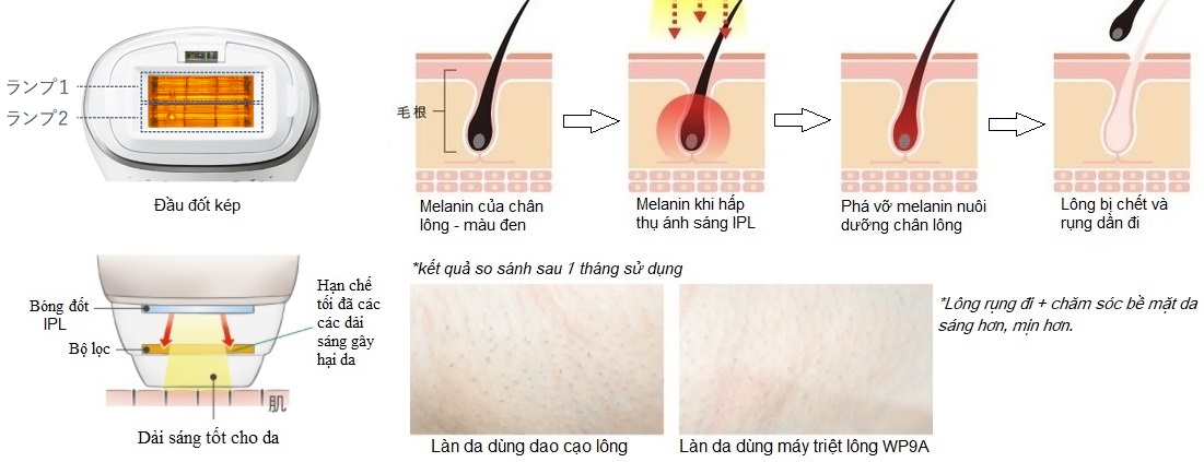 máy triệt lông panasonic