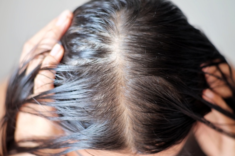 Nguyên nhân của tóc da dầu Do thói quen chăm sóc tóc sai cách