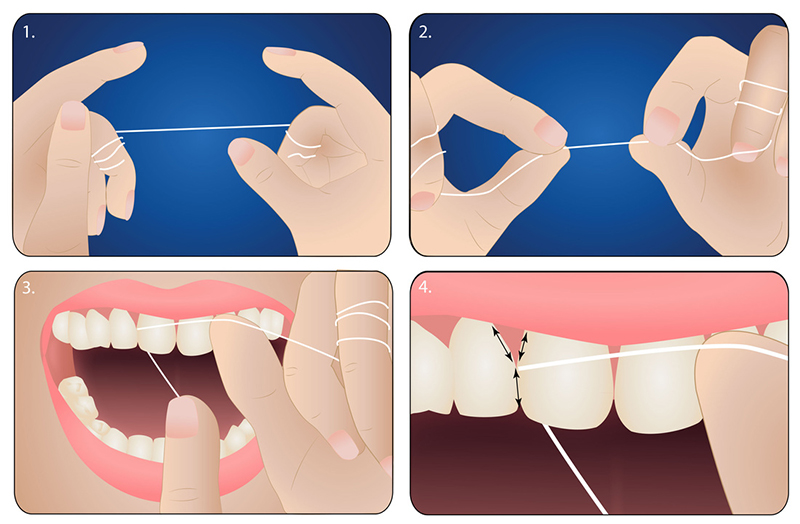Chỉ nha khoa Jomi / Oral B - 50m