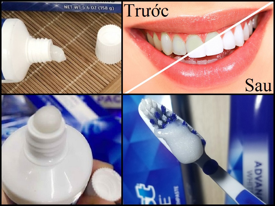 Kem Đánh Răng Crest 3D White Advanced Triple Whitening - 147g