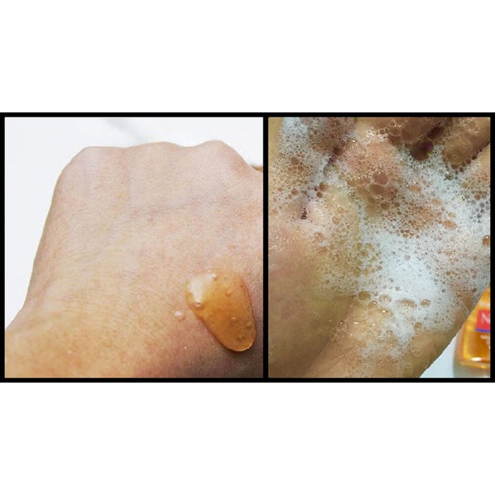 Sữa Rửa Mặt Neutrogena Oil - Free Acne Wash MicroClear - 175ml