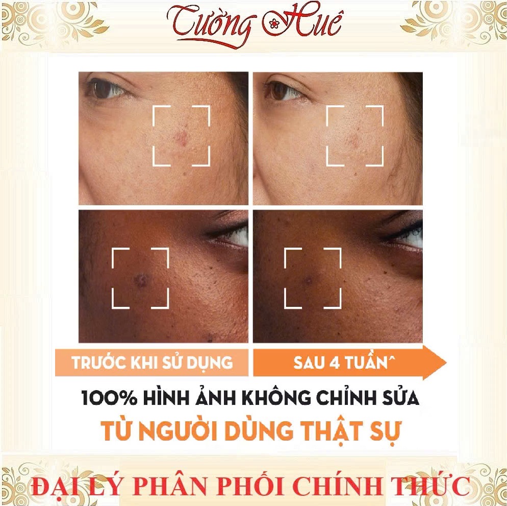 [HàngCóTem] Kem Olay Luminous Niacinmamide Dưỡng Ẩm Làm Mờ Thâm Nám Và Đốm Nâu 50g - Có Lựa Chọn