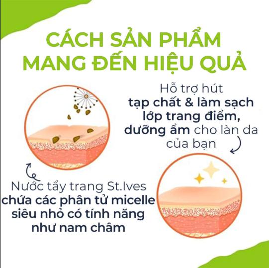 Nước Tẩy Trang St. Ives chiết xuất từ thiên nhiên dành cho mọi loại da - 400ml (Có Lựa Chọn)