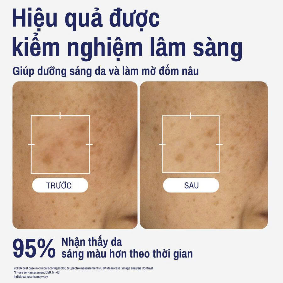 Tinh Chất Làm Sáng Da Cetaphil Bright Healthy Radiance Perfecting Serum 30ml
