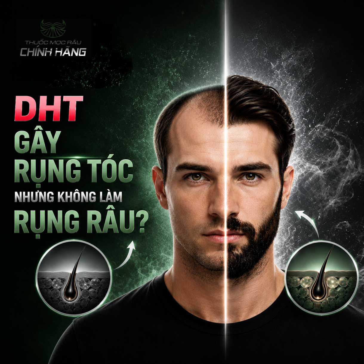 Tại Sao DHT Gây Rụng Tóc Nhưng Không Làm Rụng Râu?
