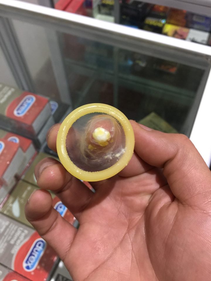 CHẤT BỘT MÀU TRẮNG Ở ĐẦU BAO CAO SU LÀ GÌ ?