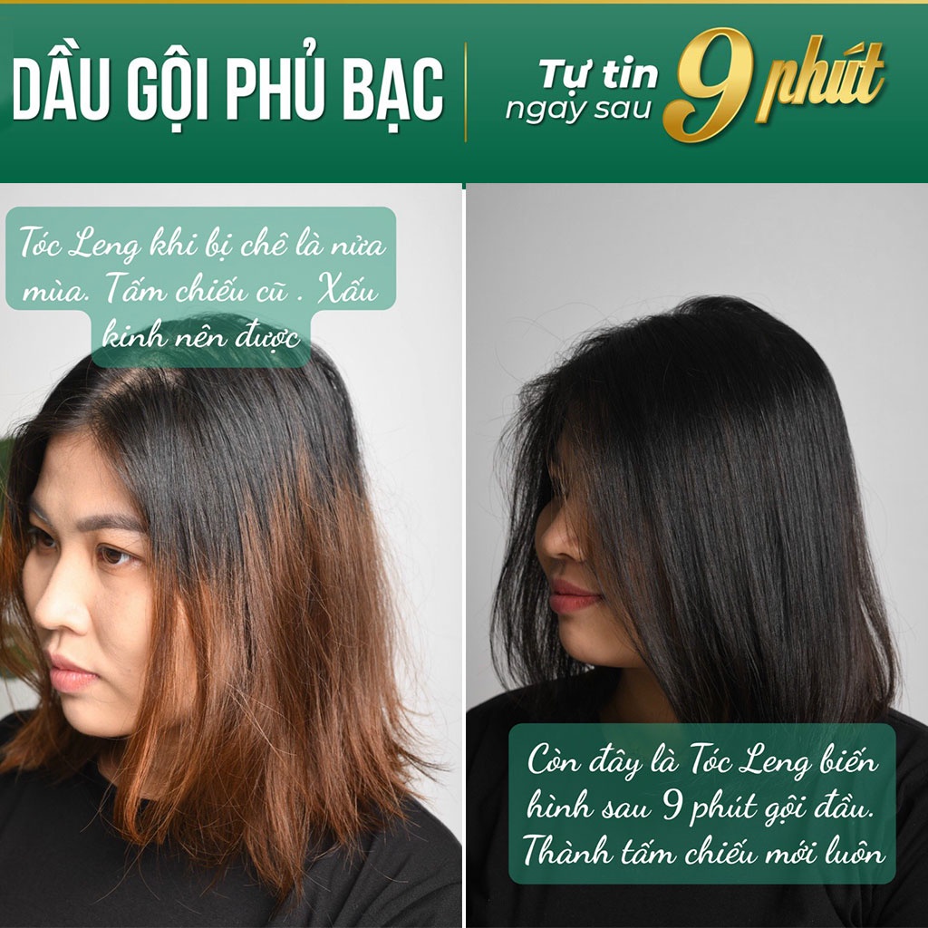 Tóc bạc sớm - nỗi khổ hay món quà độc đáo màu bạch kim?