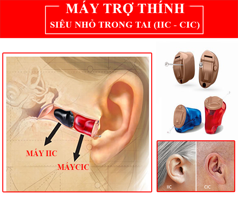 Máy trợ thính trong tai siêu nhỏ IIC - CIC