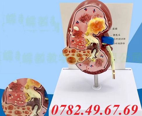 Mô hình giải phẫu vùng thận và cầu thận