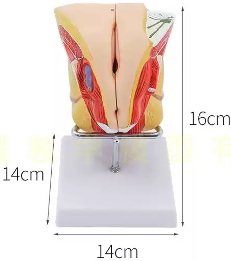 Mổ u xơ tử cung đơn giản hơn bạn nghĩ