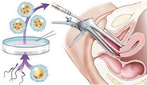 PGT – XÉT NGHIỆM DNA PHÁT HIỆN BẤT THƯỜNG DI TRUYỀN TRƯỚC CHUYỂN PHÔI