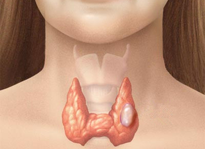 THYROGLOBULIN (TG): DẤU ẤN UNG THƯ TUYẾN GIÁP