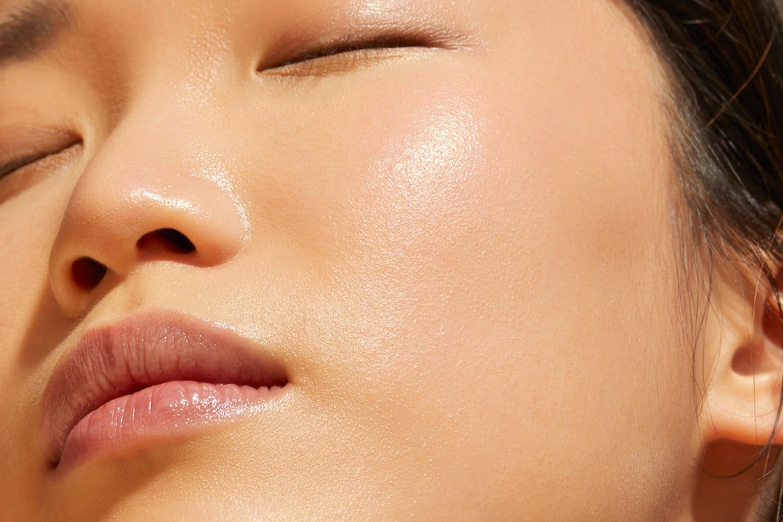 Phân Biệt Sẹo Lõm Mới Hình Thành Với Lỗ Chân Lông To!