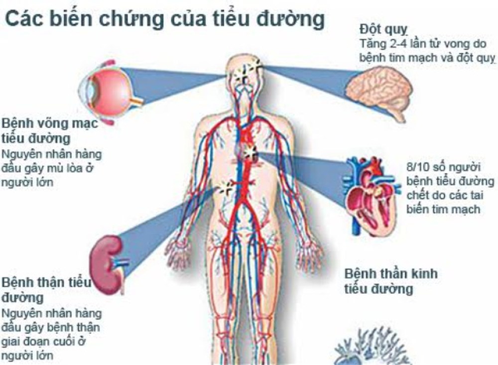 NGĂN NGỪA CÁC BIẾN CHỨNG TIỂU ĐƯỜNG