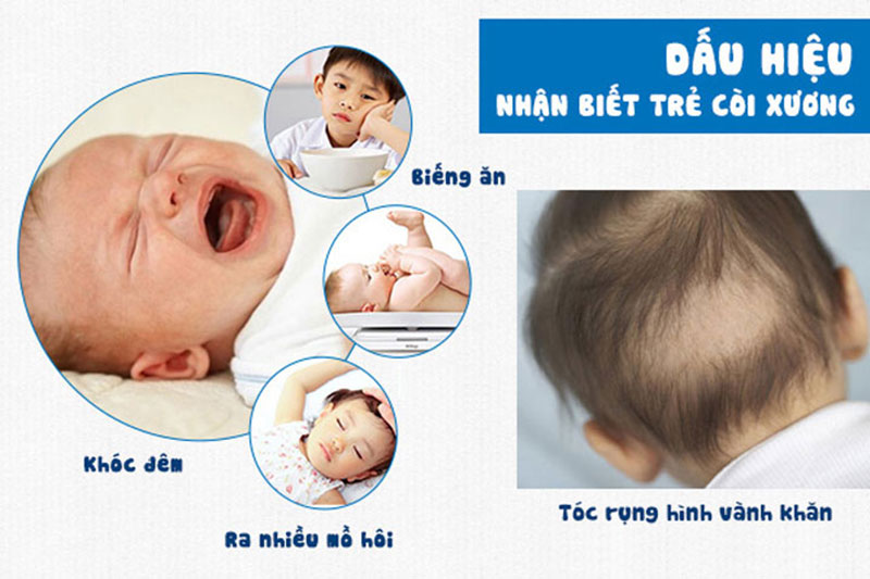 cac-vai-tro-quan-trong-cua-canxi-doi-voi-co-the-cua-tre