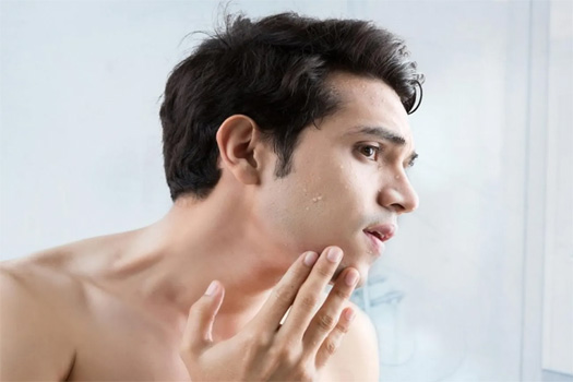 TOP 10 SỮA RỬA MẶT CHO NAM DA DẦU MỤN CHỈ TỪ 100K