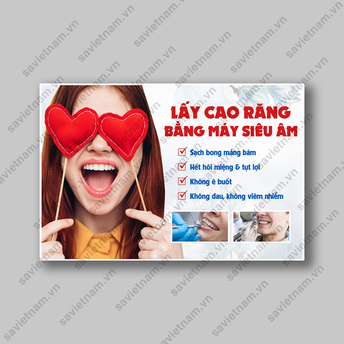 Tranh nha khoa Lấy cao răng bằng máy siêu âm