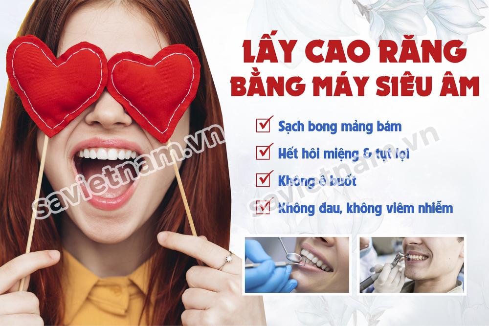 Tranh nha khoa lấy cao răng bằng máy siêu âm