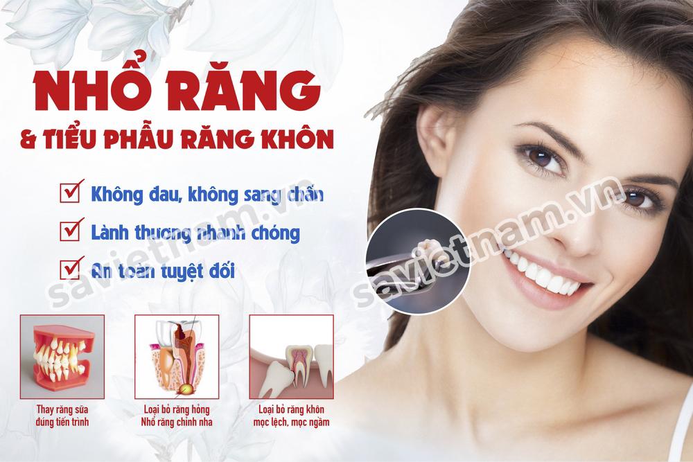 Tranh nha khoa Nhổ răng và tiểu phẫu răng khôn