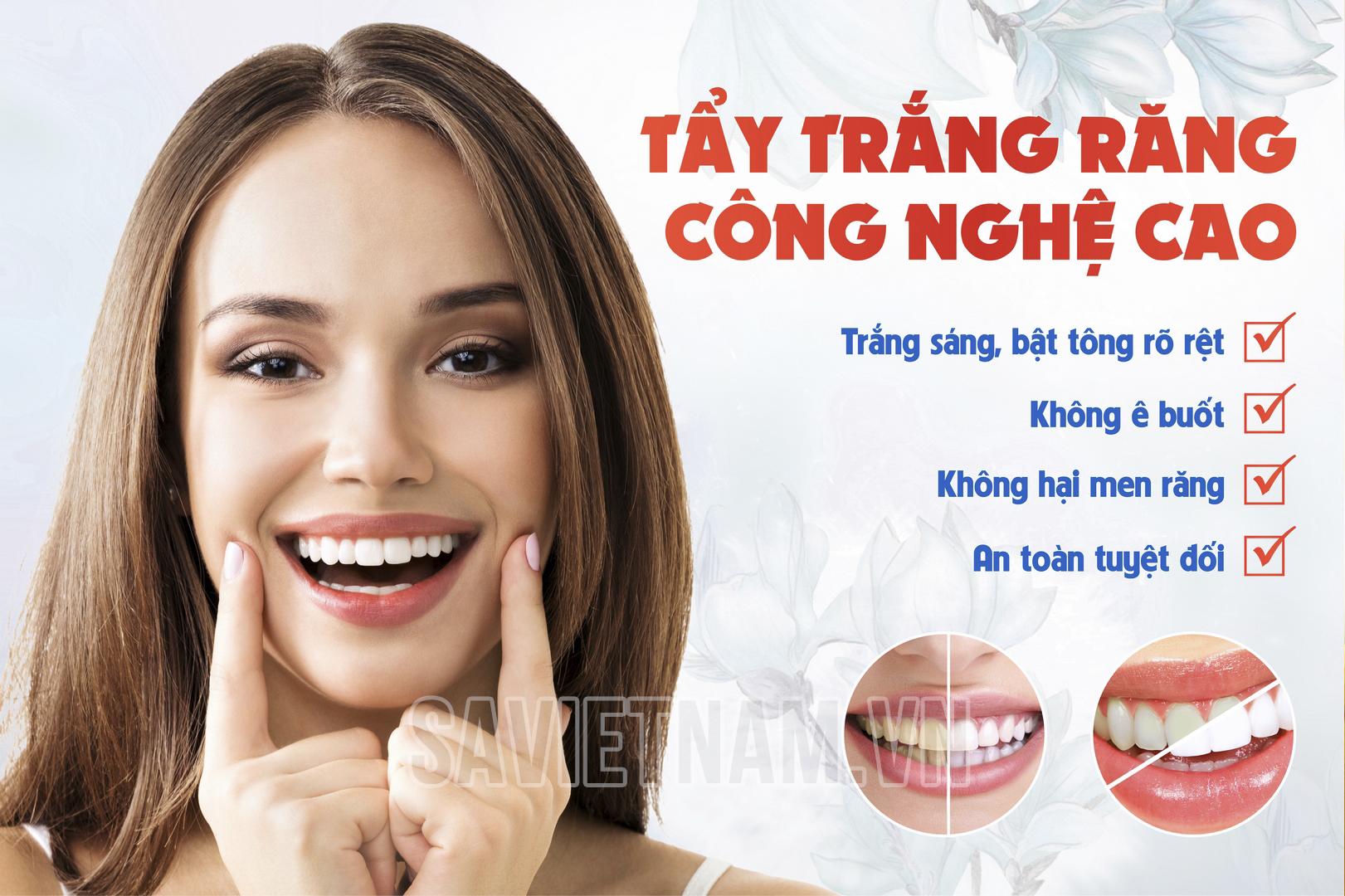 Tranh tẩy trắng răng công nghệ cao – Công ty TNHH Nha khoa SA Việt Nam