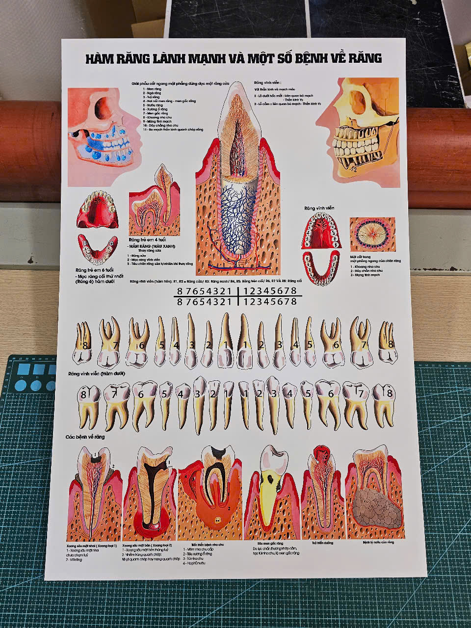 tranh Hàm răng lành mạnh và một số bệnh lý về răng