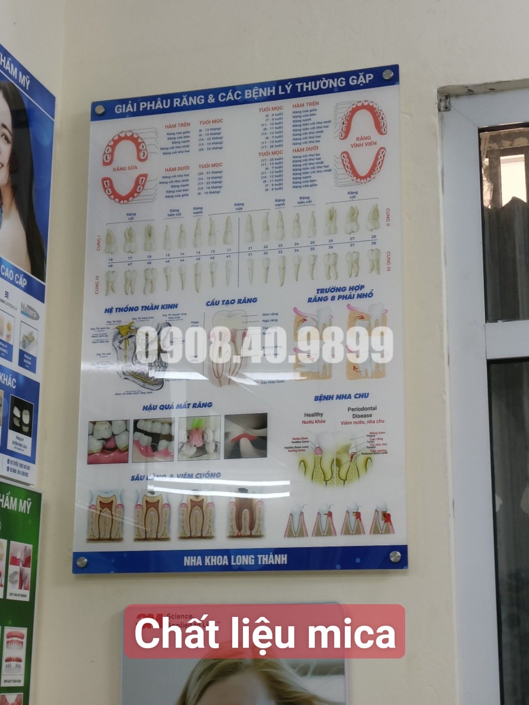 Tranh giải phẫu và các bệnh lý thường gặp