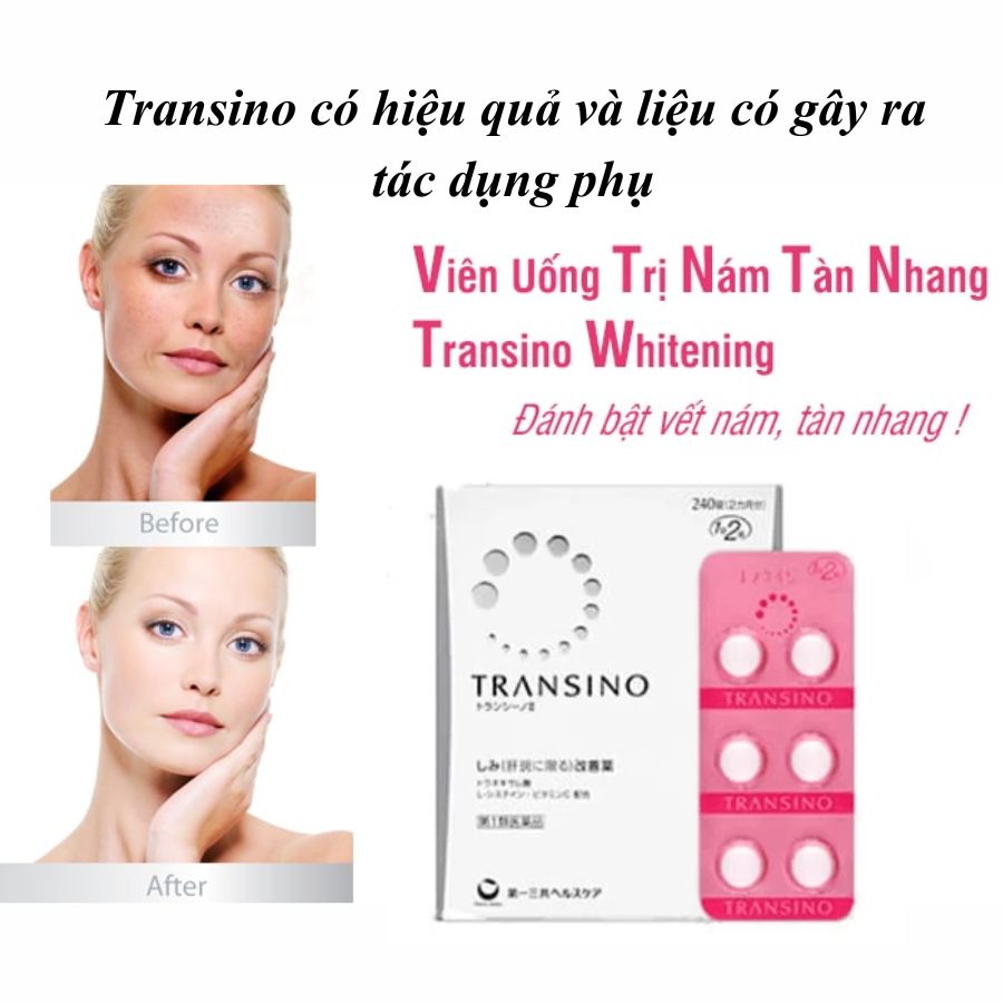 Viên uống trị nám Transino có hiệu quả không và liệu có tác dụng phụ không?