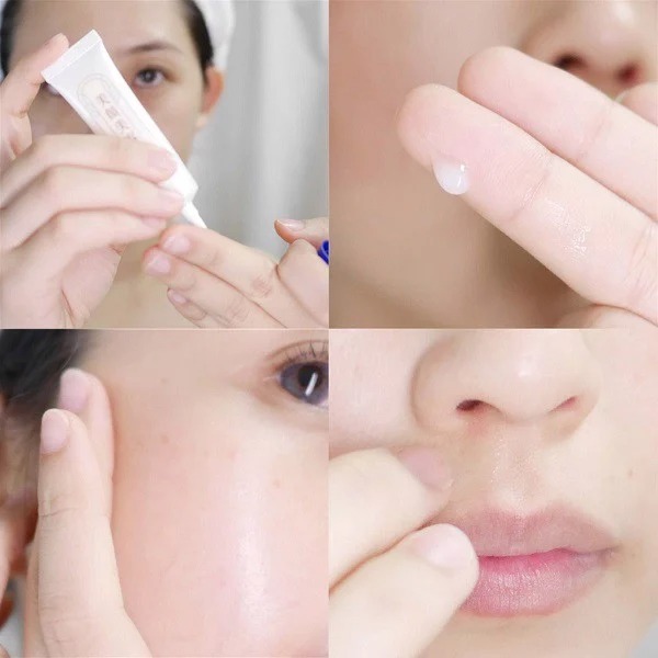 Tinh Chất Dưỡng Ngăn Ngừa Mụn Bigan Acne Essence meishoku 15g