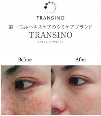 Viên uống trị nám Transino Whitening 240 viên - Hàng Nhật nội địa