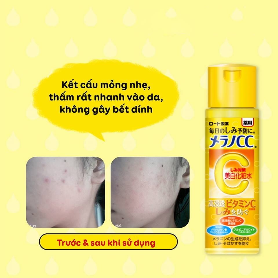 Nước hoa hồng CC Melano Rohto Lotion trắng da trị thâm nám tàn nhang 170ml