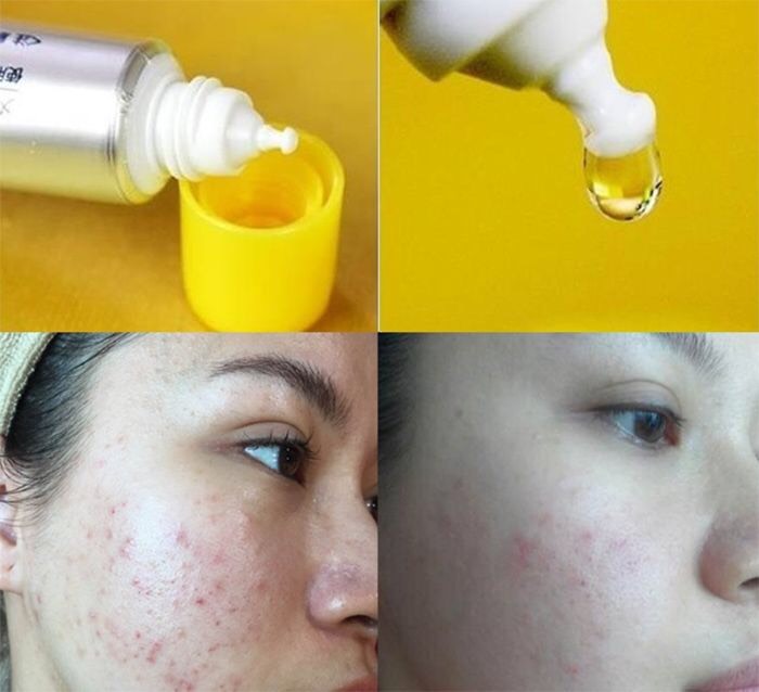 Serum Vitamin C Melano CC Rohto (Tinh chất đặc trị thâm nám)