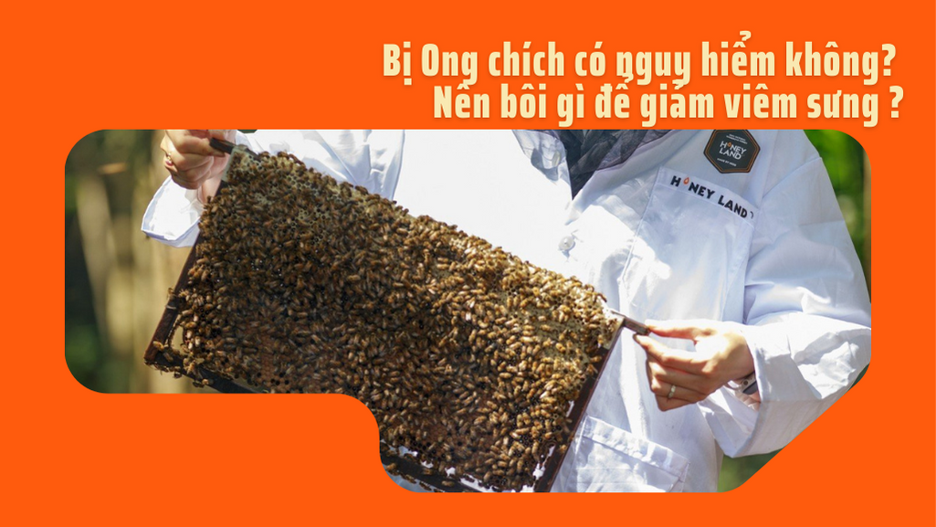 BỊ ONG CHÍCH CÓ NGUY HIỂM KHÔNG? BÔI GÌ ĐỂ GIẢM VIÊM SƯNG?