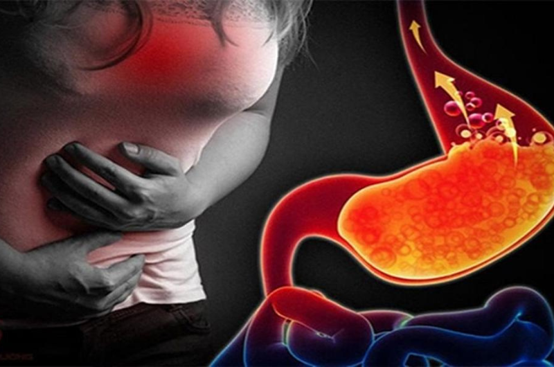 Ợ CHUA? ĐỪNG XEM THƯỜNG DẤU HIỆU NÀY
