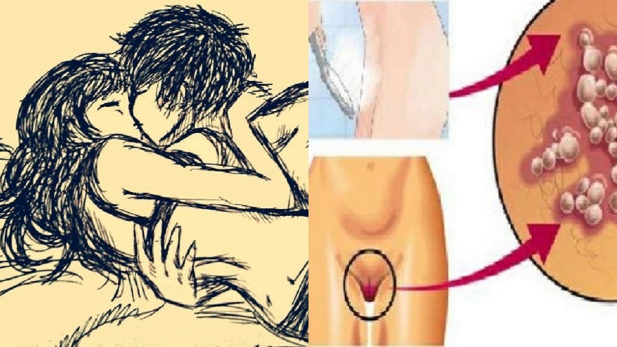 Bị-viêm-âm-đạo-có-kiêng-quan-hệ-tình-dục-không?