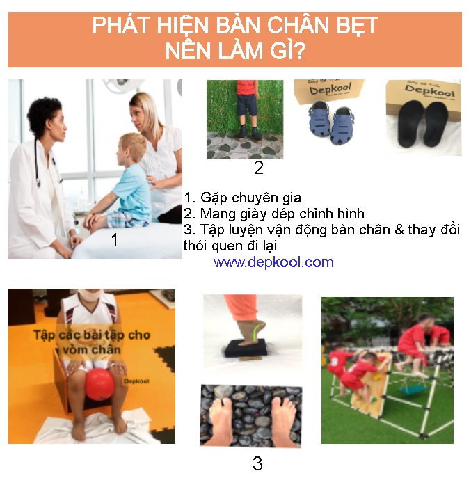 Trẻ có dấu hiệu Bàn Chân Bẹt - Bạn nên làm gì ?