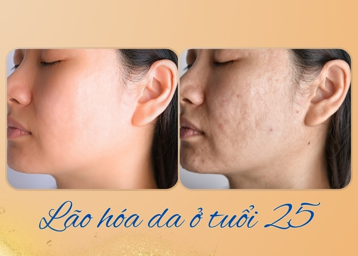 chong-lao-hoa-sau-tuoi-25