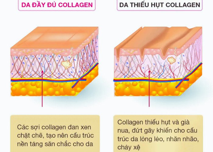 uống collagen có tác dụng phụ không 