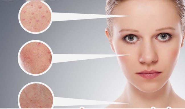 Làm thế nào để nhận biết bị rối loạn nội tiết?