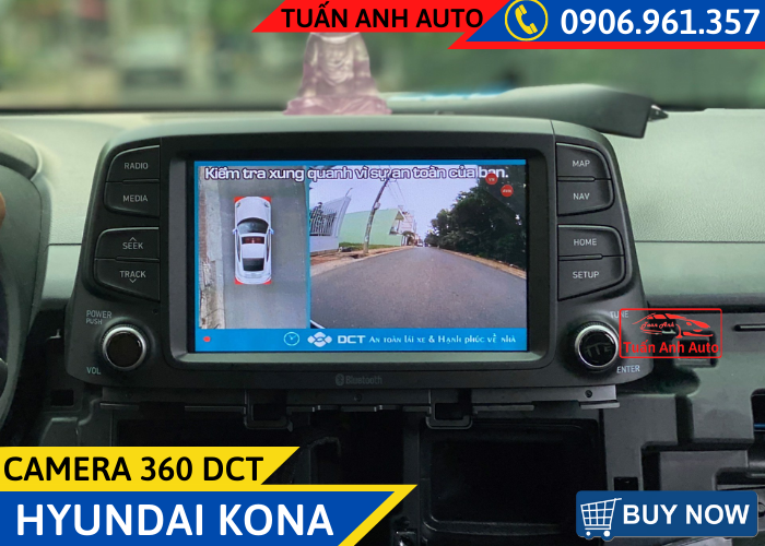 Camera 360 DCT- Hyundai Kona