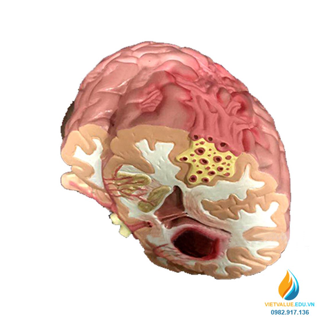 Mô hình bệnh lý não và cấu trúc, chất liệu nhựa PVC, mô hình y ...