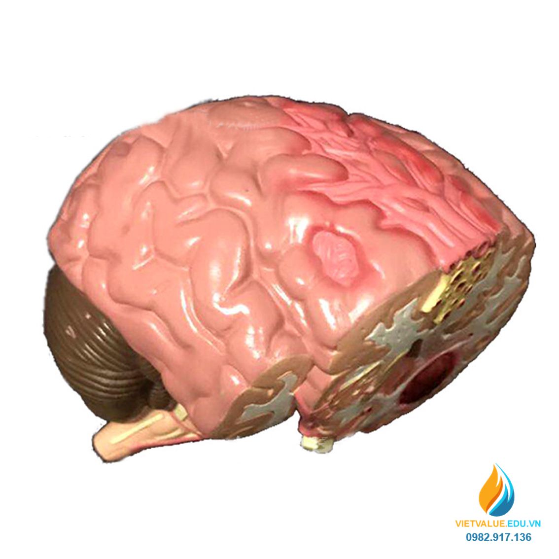 Mô hình bệnh lý não và cấu trúc, chất liệu nhựa PVC, mô hình y ...