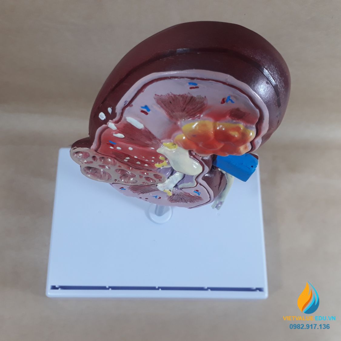 Mô hình giải phẫu thận và cầu thận
