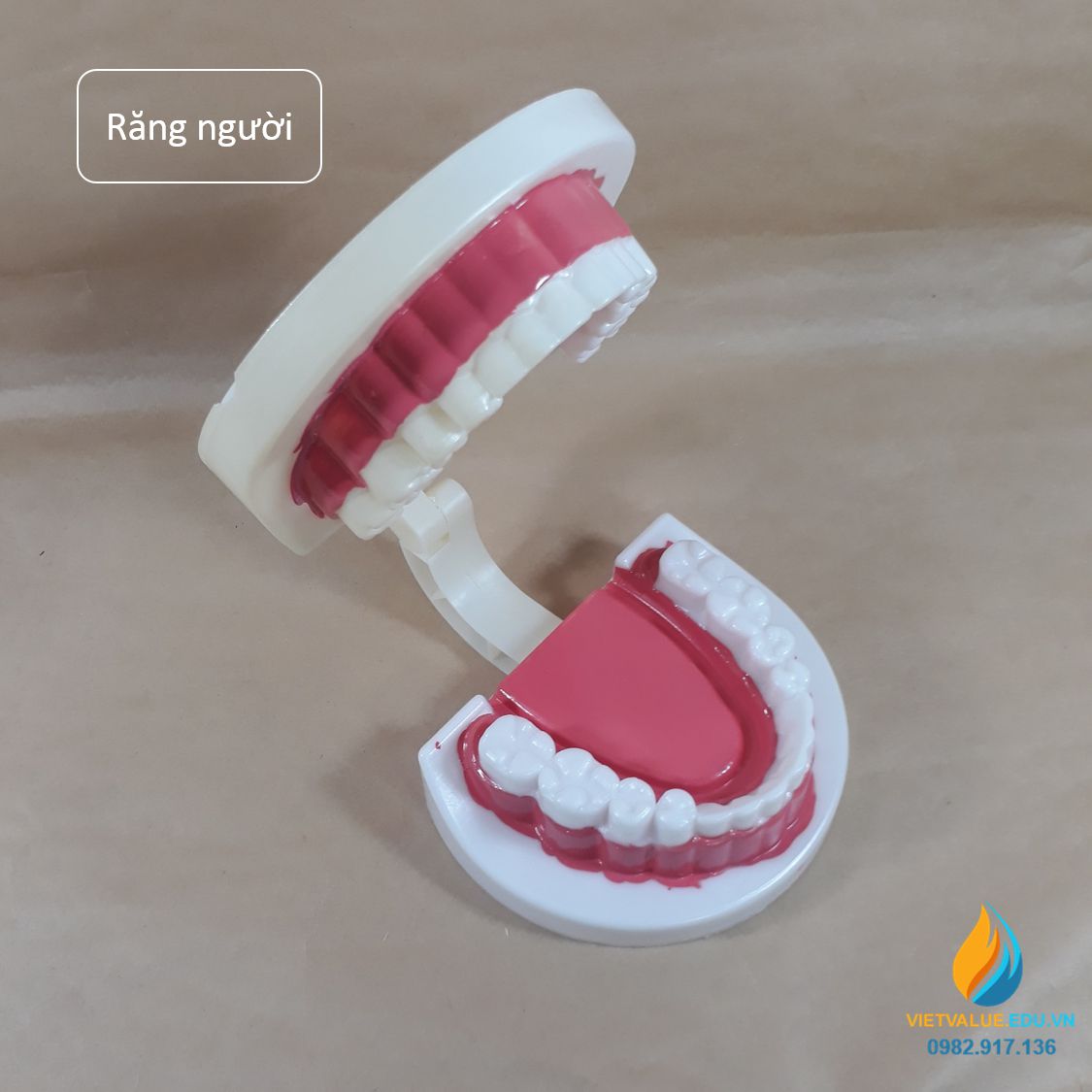 Mô hình bệnh lý hàm răng trong suốt