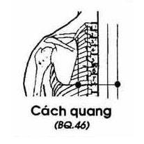 Cách Quan