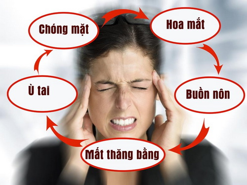 Một số cách chữa bệnh tiền đình không cần thuốc