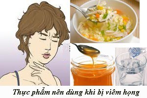 Người bị viêm họng nên ăn gì để nhanh khỏi bệnh?