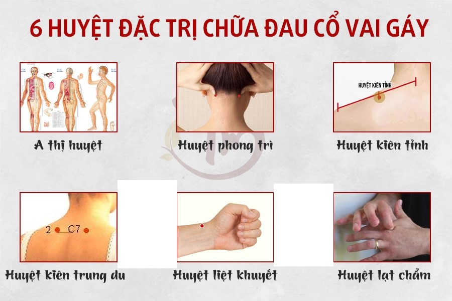 mach-ban-6-huyet-dac-tri-dau-co-vai-gay