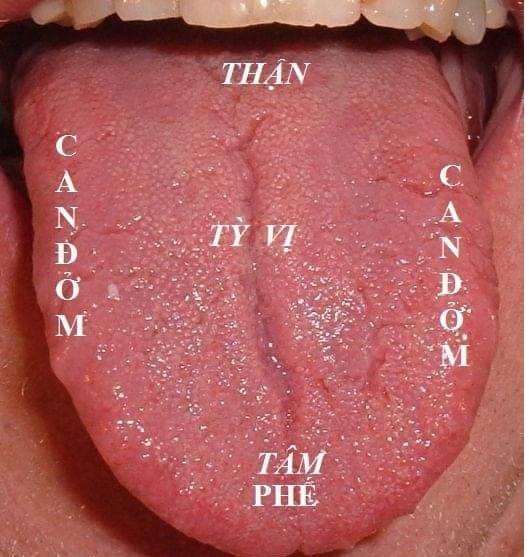 ĐÔNG Y CHUẨN BỆNH QUA MÀU SẮC LƯỠI